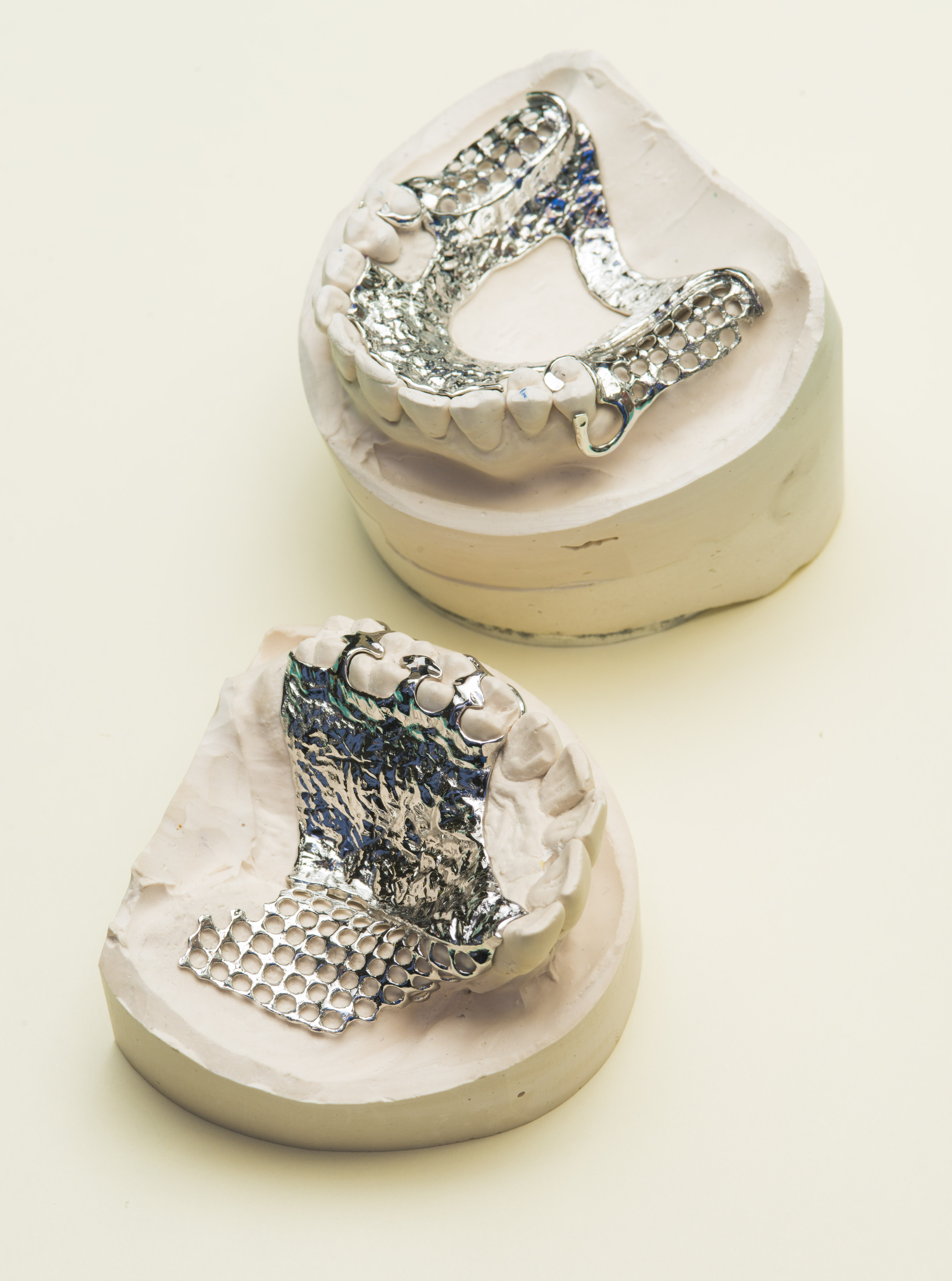 3D 列印製造的 RPD，已拋光並可開始齒模建構。
