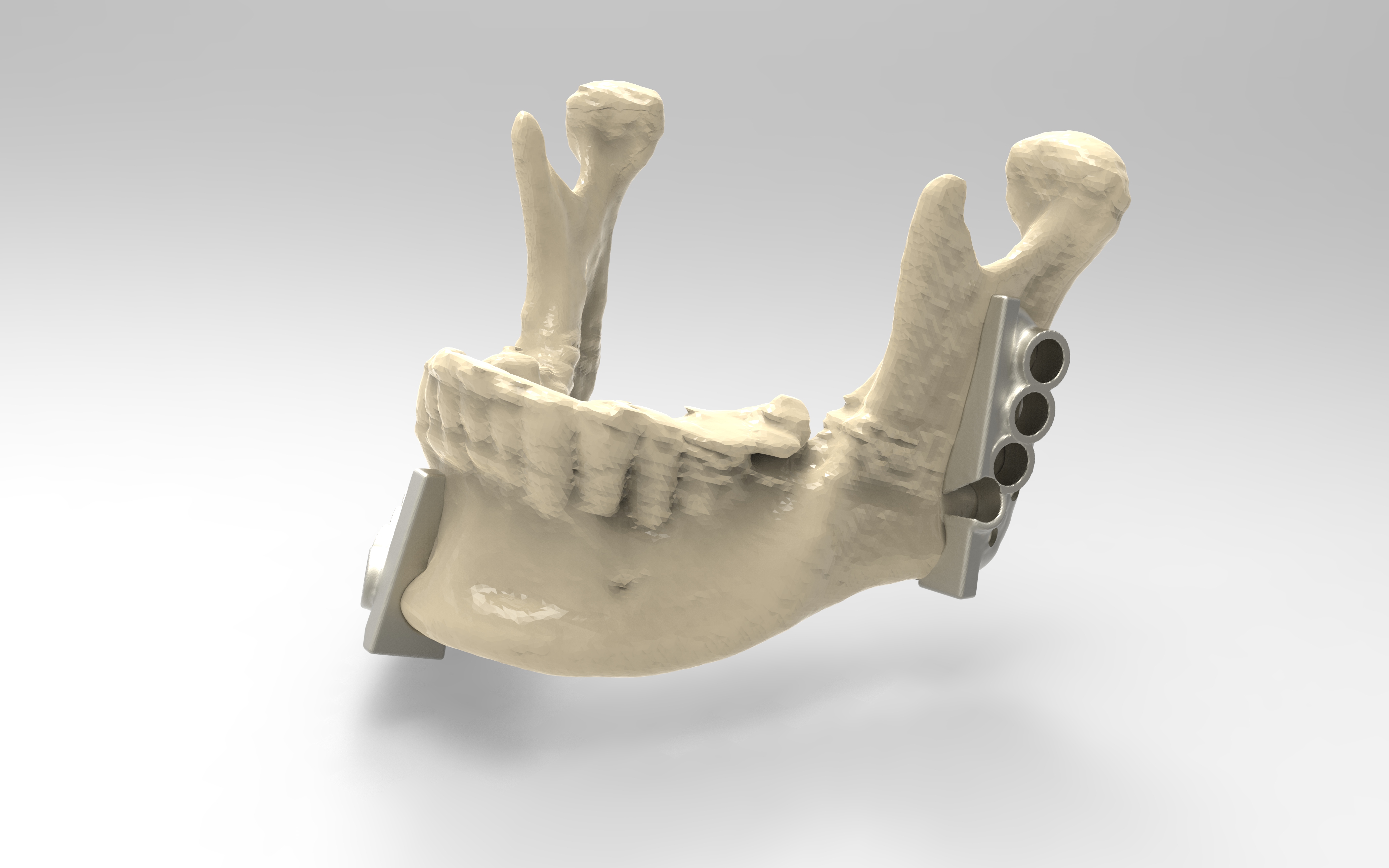 Jaw model with cutting guides